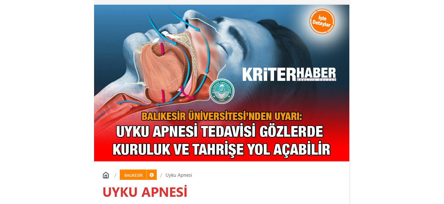 Uyku Apnesi